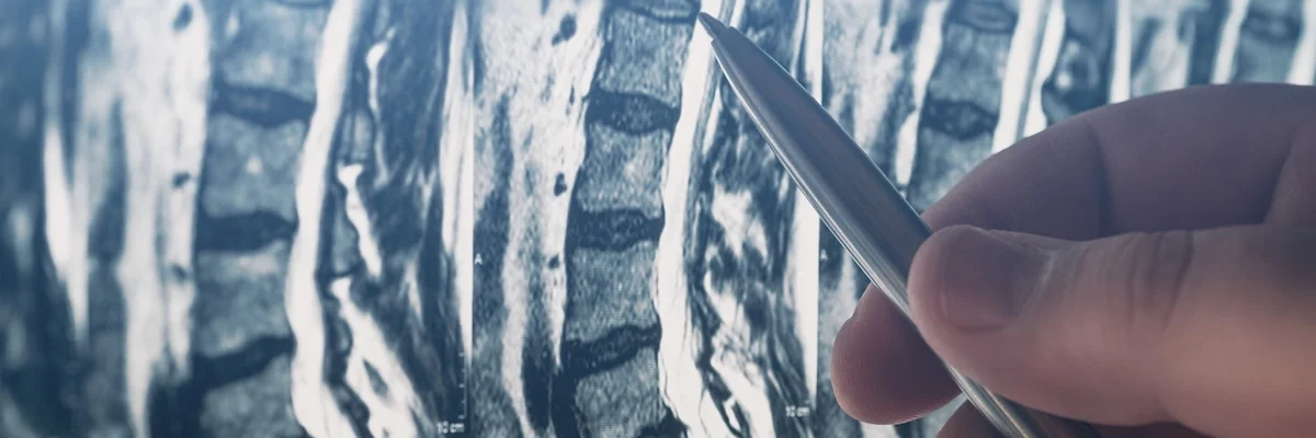 Nonsurgical Pain Relief - Richard Kim Medicine Nonsurgical Pain Relief - Richard Kim Medicine